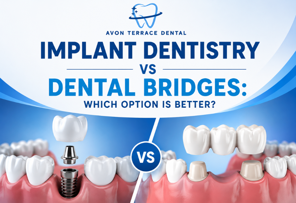 Implant Dentistry vs Dental Bridges