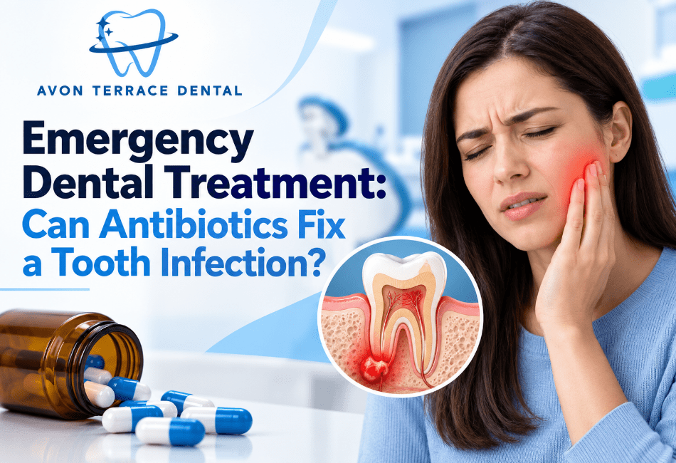 Emergency dental treatment for a tooth infection and dental abscess